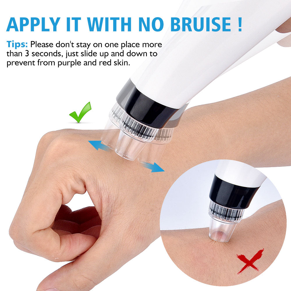 Blackhead Remover Vacuum Suction